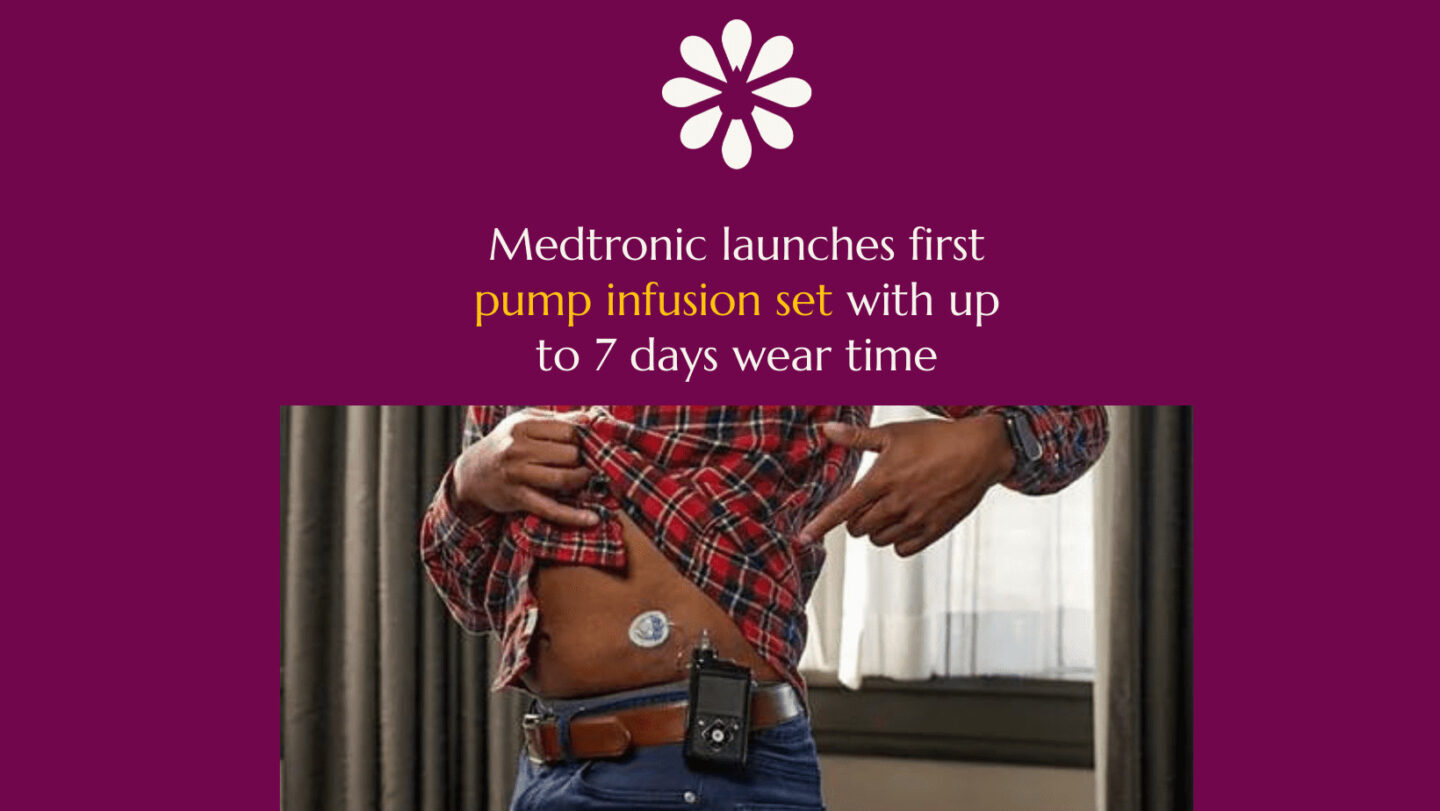 Man showing off insulin pump infusion set under shirt.